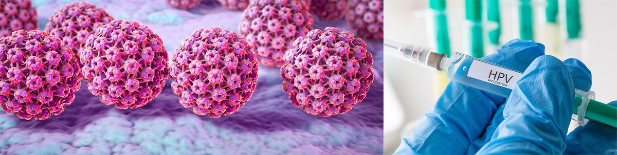 HPV-Impfung / HPV-Infektion KSW