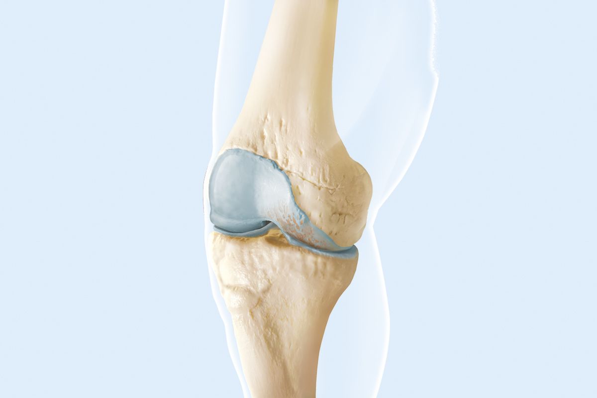 Arthrose: Symptome, Verlauf, Behandlung