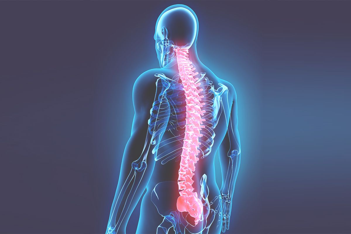 Morbus Bechterew / Spondylitis Ankylosans