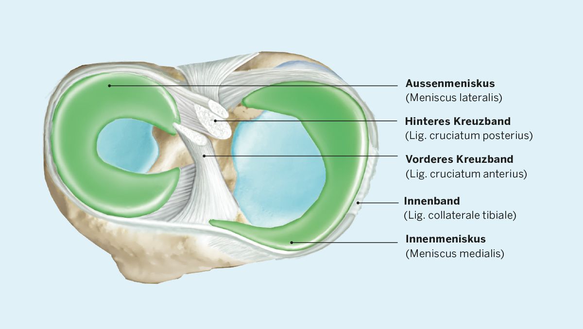 Querschnitt Meniskus / Knie KSW