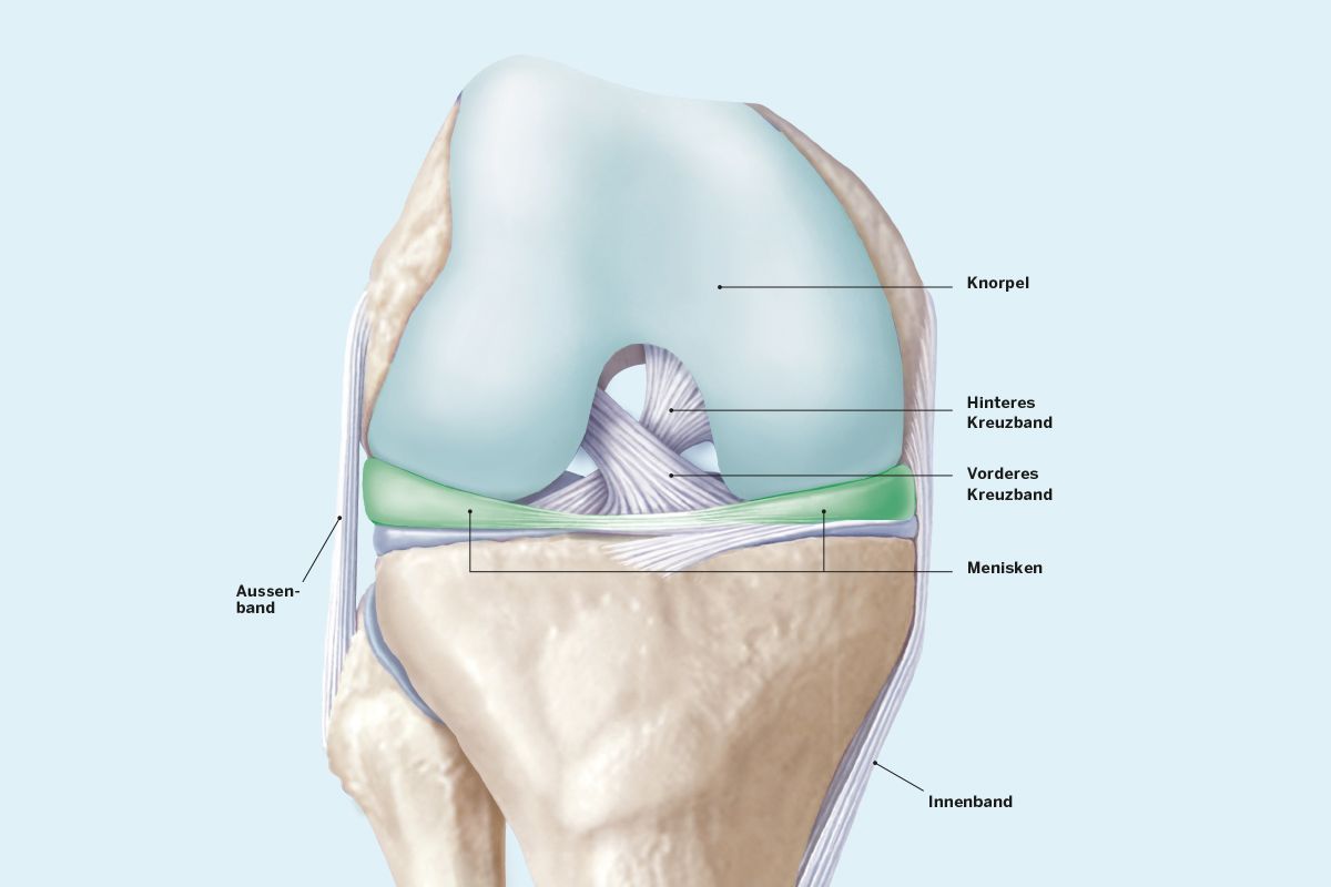 Vorderer Kreuzbandriss / Vordere Kreuzbandruptur KSW